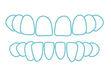 Are Spark™ Aligners Right for You?