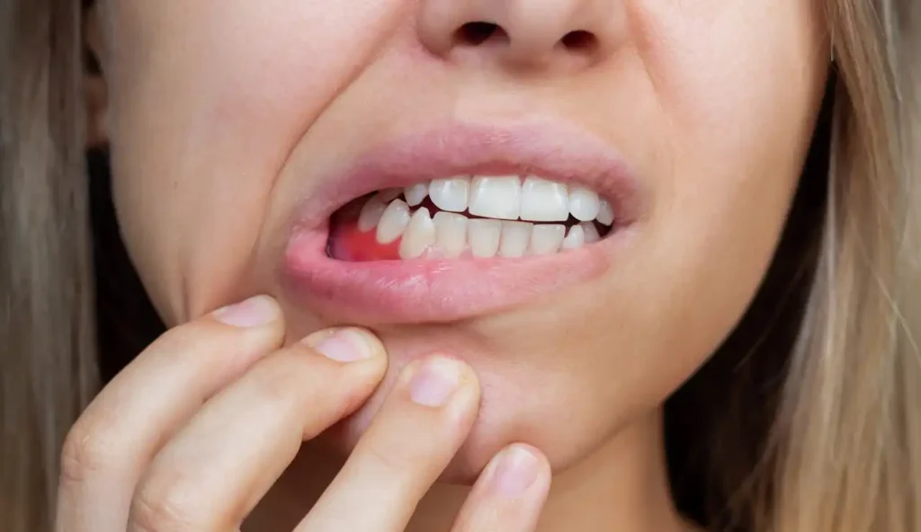 Bleeding Gums? Causes and Treatment Options in Woden Valley