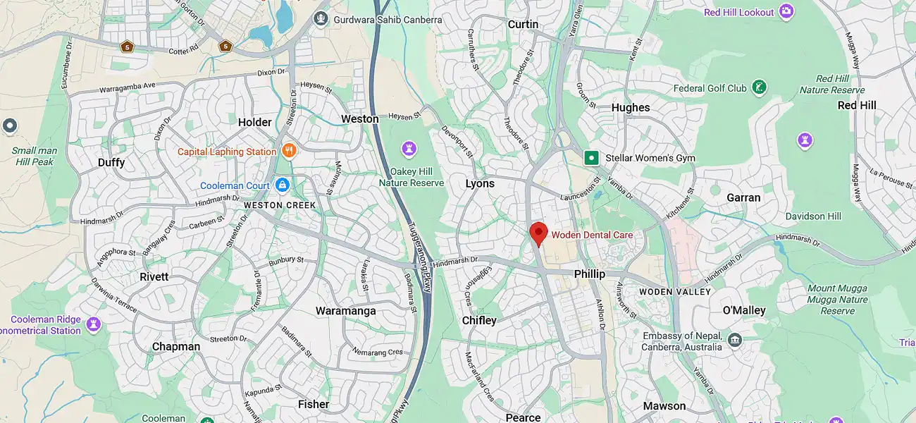 Service Areas - Dentist in Woden Valley & Surrounding Suburbs