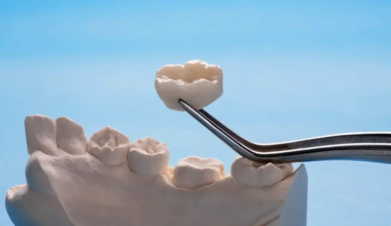 Same-Day Tooth Repair in Canberra