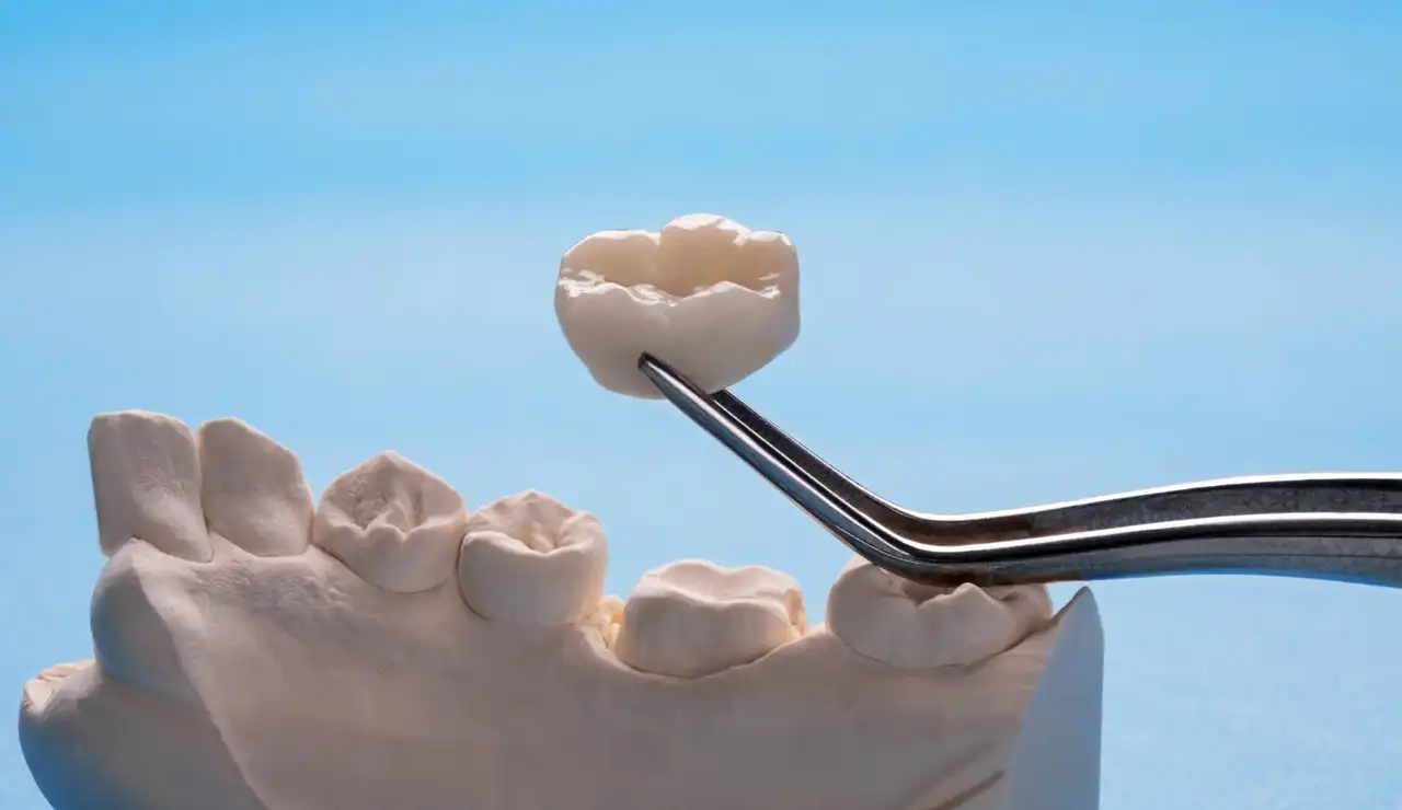 Same-Day Tooth Repair in Canberra