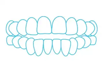 Are Spark™ Aligners Right for You?