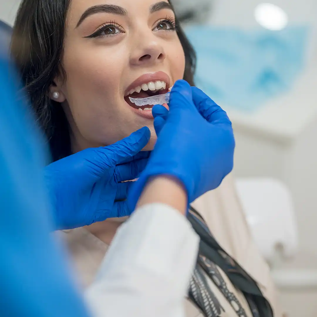 Are Spark Aligners Right for You?