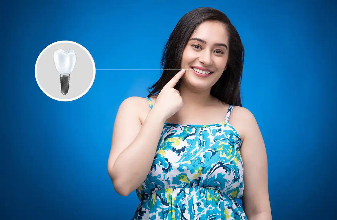Dental Implants in Woden, Canberra