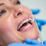 How Long Do Dental Implants Last