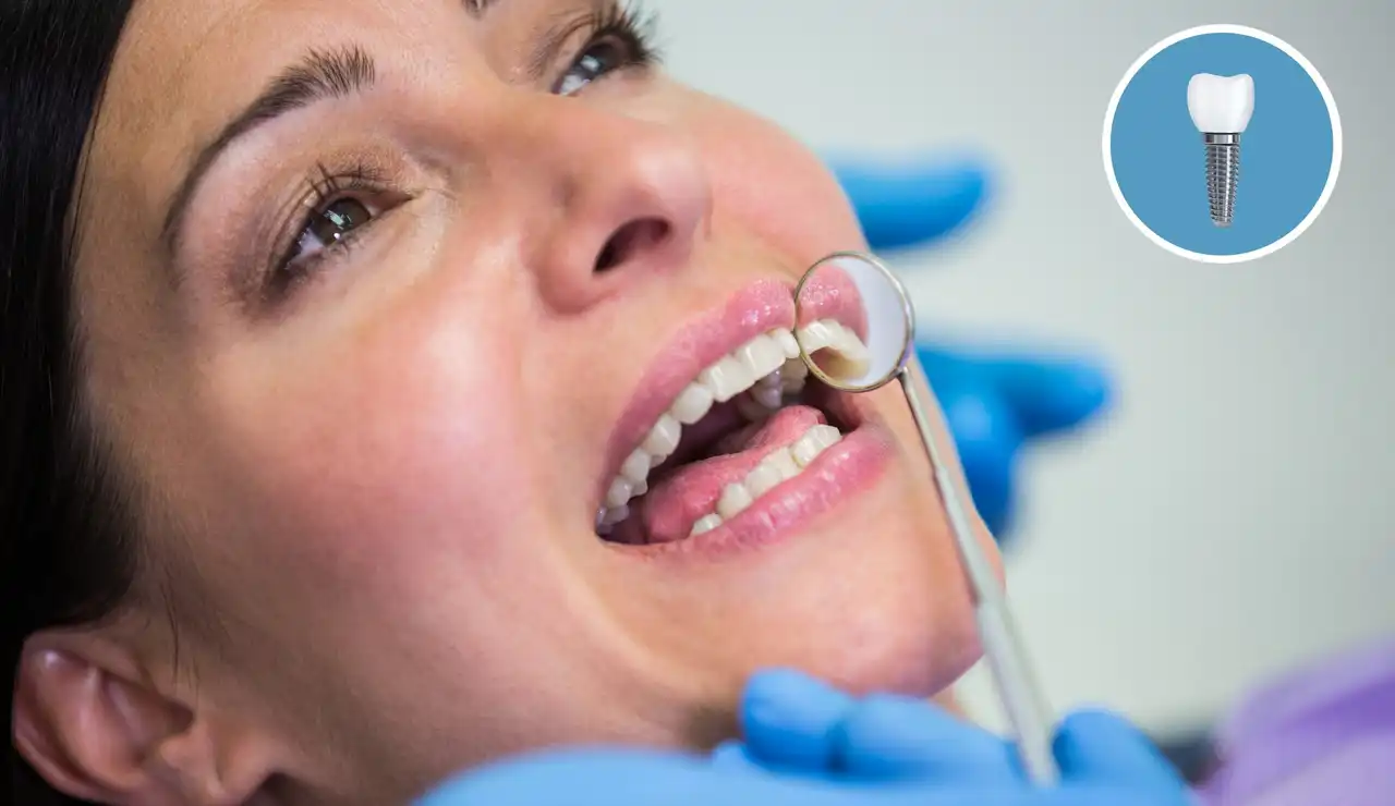 How Long Do Dental Implants Last