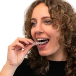 Spark Clear Aligners: The Future of Comfortable Orthodontics
