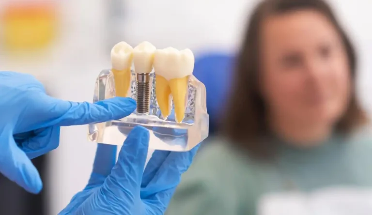 What Are Dental Implants? A Beginner’s Guide
