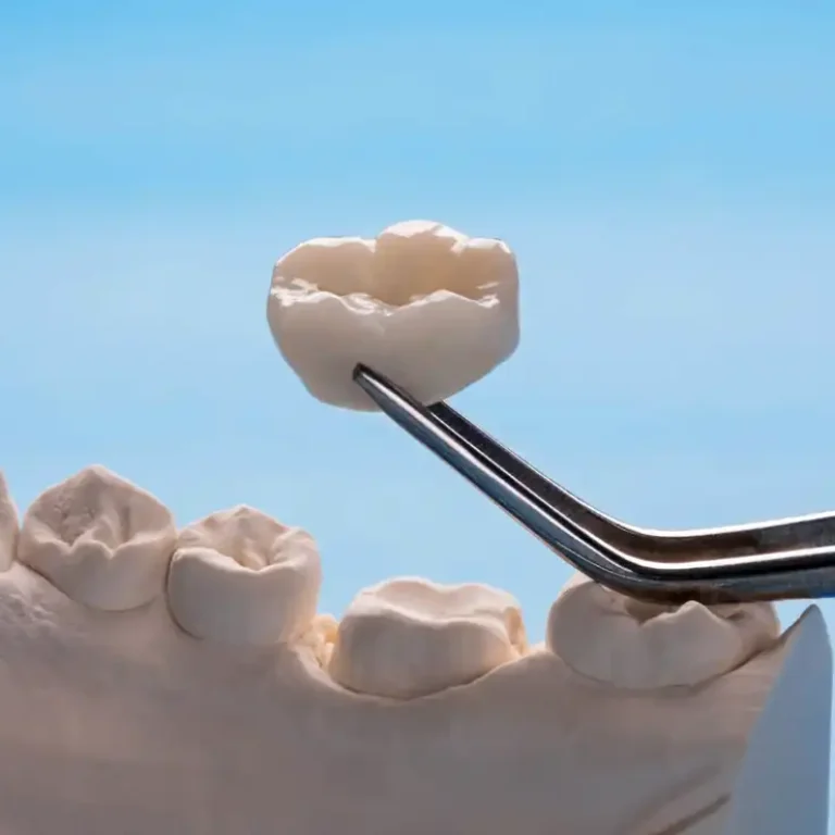 Same-Day Tooth Repair in Canberra